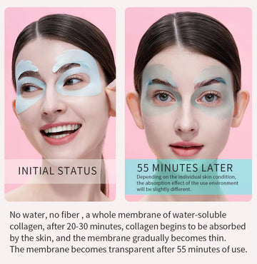 Mond’Sub Bio-Collagen Eye Mask (1 Pair) – Hydrating, Brightening & Anti-Aging Hydrogel Mask for Wrinkles, Dark Circles & Puffy Eyes